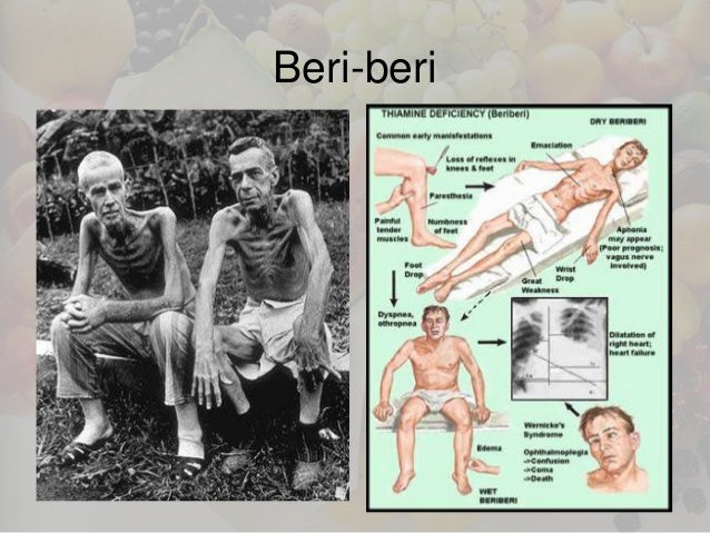 1 menilai kepentingan amalan pengambilan nutrisi dan ...