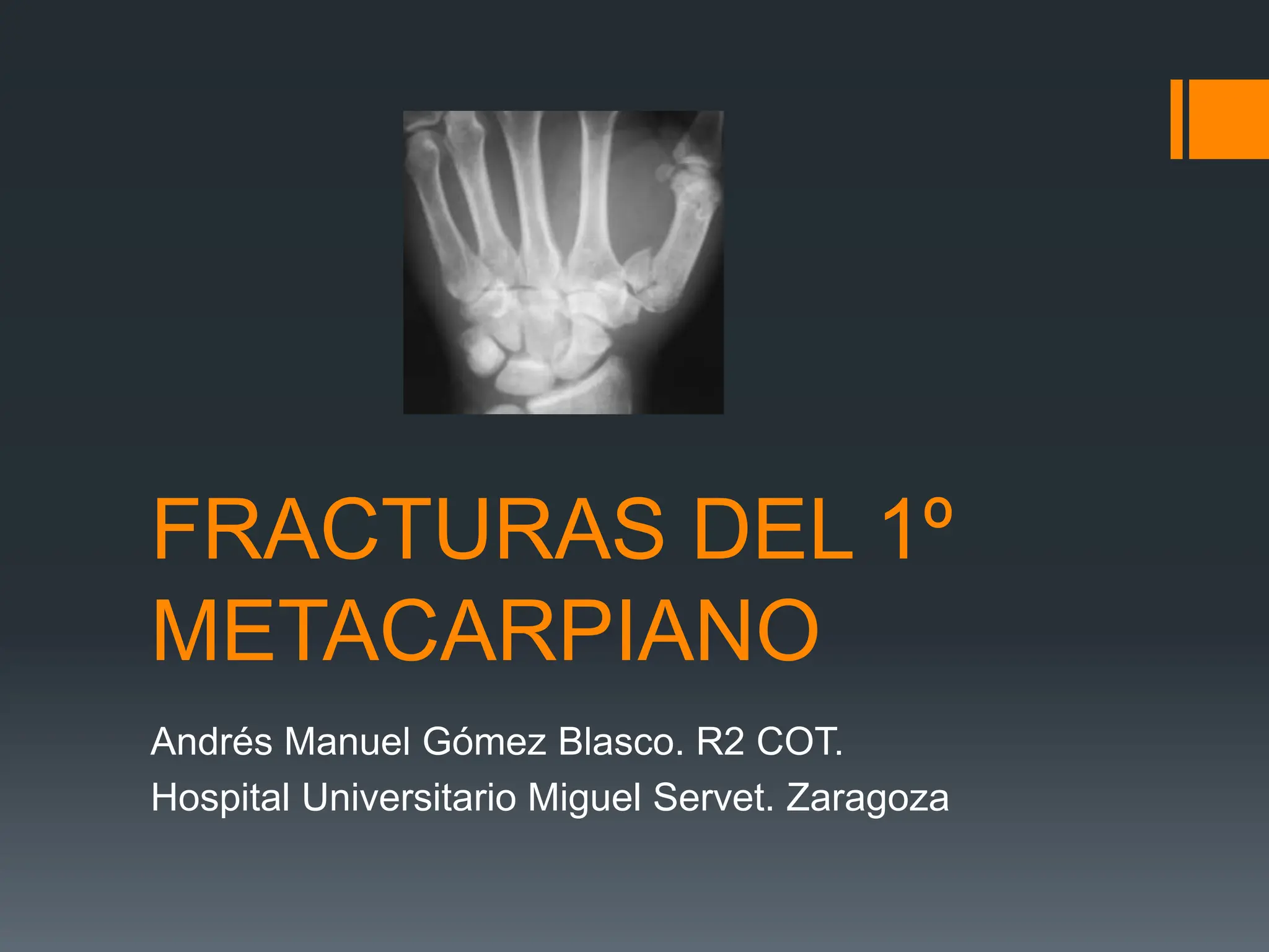 fracturas 1º metacarpiano de la mano y tratamiento | PPTX