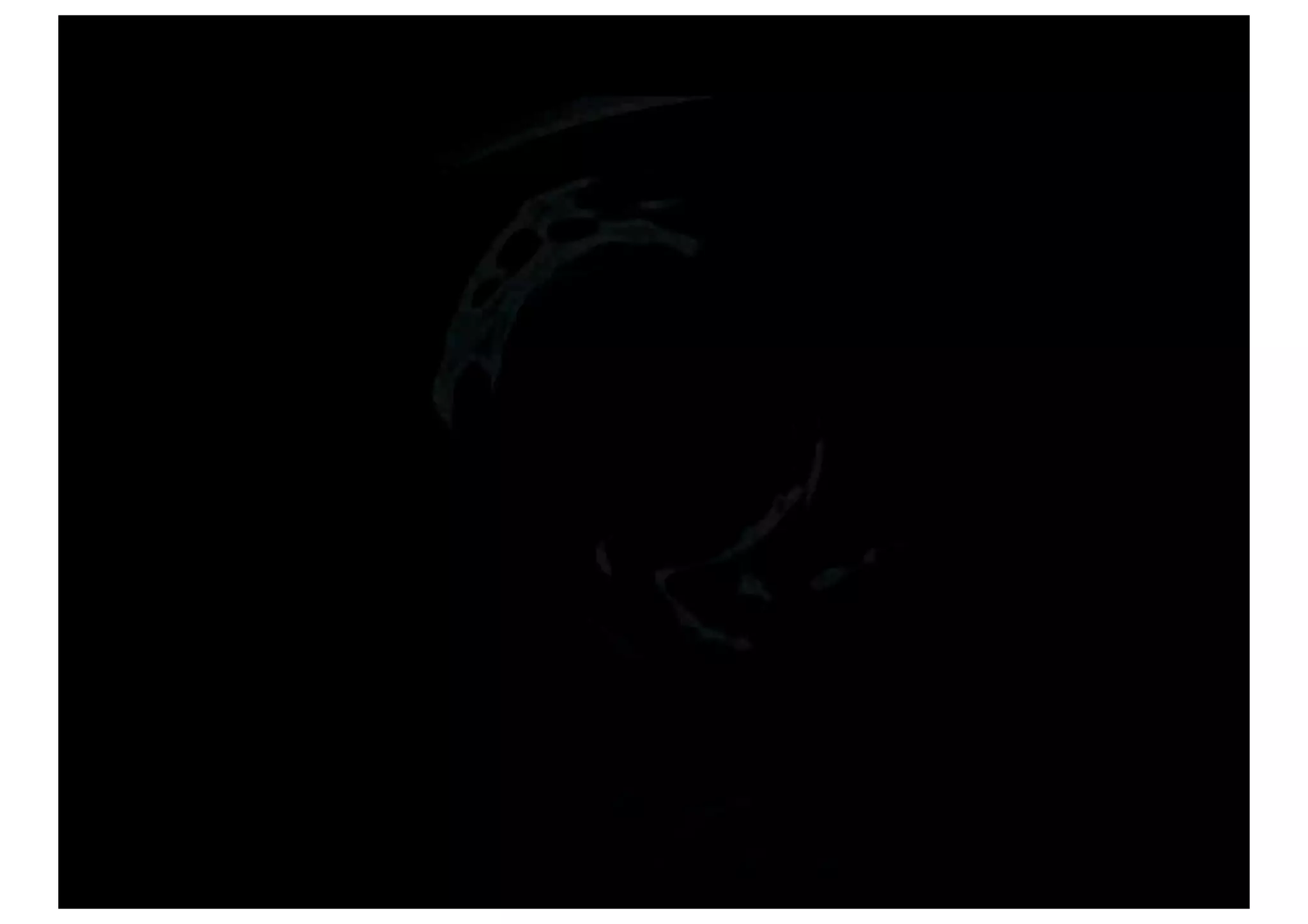 Play For Your Life part 1: Microsoft Kinect