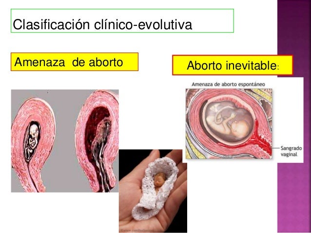 Duele el pecho duele la parte inferior del vientre y los riñones
