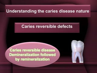 [1][m] minimally invasive restorative dentistry | PPTX