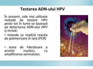 În prezent, cele mai utilizate
metode de testare HPV
peste tot în lume se bazează
pe detectarea ADN-ului HPV
şi includ:
• metode ce implică reacţia
de polimerizare în lanţ (PCR)
• teste de hibridizare a
acizilor nucleici, cu
amplificarea semnalului.
Testarea ADN-ului HPV
 