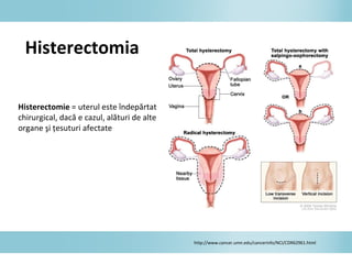 Histerectomia
Histerectomie = uterul este îndepărtat
chirurgical, dacă e cazul, alături de alte
organe şi ţesuturi afectate
http://www.cancer.umn.edu/cancerinfo/NCI/CDR62961.html
 