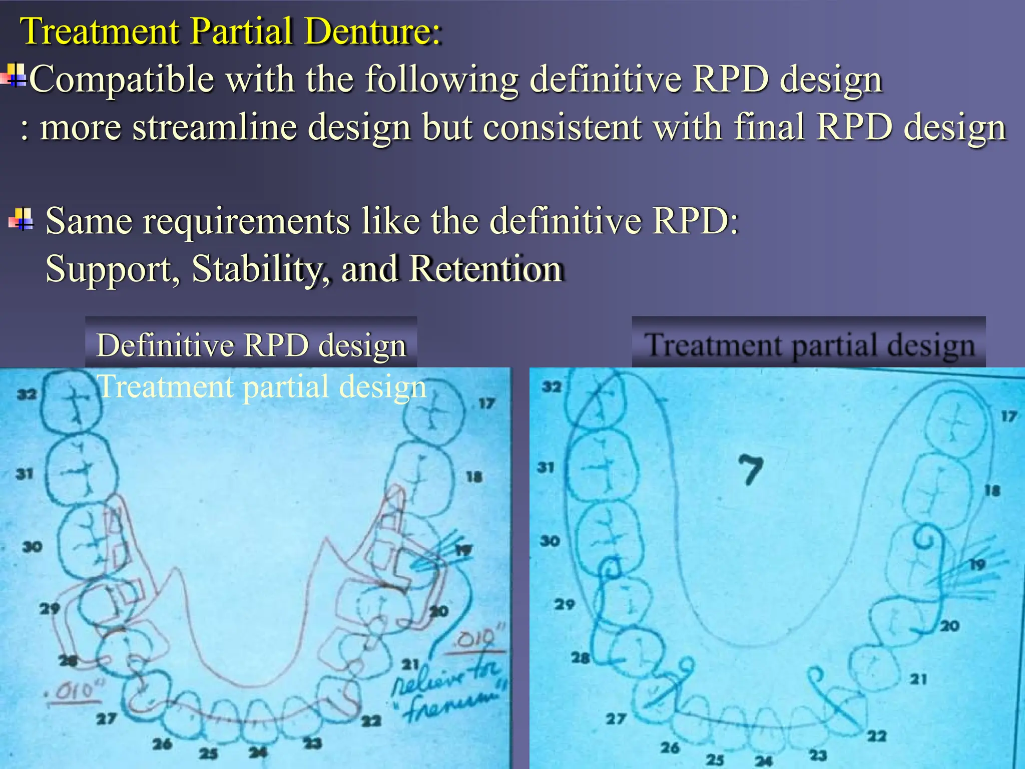(1)Mouth preparation for removable partial denture march 2020 ppt.pptx
