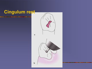 (1)Mouth preparation for removable partial denture march 2020 ppt.pptx