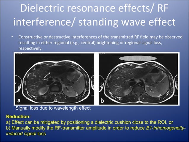 Distortion Artifacts in MRI and their correction | PPT | Digital Audio ...