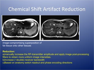 Chemical Shift Artifact Reduction

image-compromising superposition of
fat tissue onto other tissues
Reduction:
a)manually increase the RF-transmitter amplitude and apply image post-processing
filters to obtain more uniform image intensities.
b)Increase (~double) receiver bandwidth
c)Based on anatomy switch readout and phase encoding directions

 