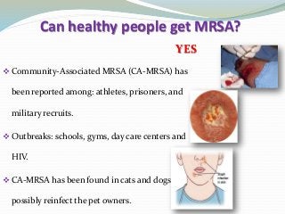 Can healthy people get MRSA?
YES
Community-Associated MRSA (CA-MRSA) has
been reported among: athletes, prisoners, and
military recruits.
Outbreaks: schools, gyms, day care centers and
HIV.
CA-MRSA has been found in cats and dogs and
possibly reinfect the pet owners.
 