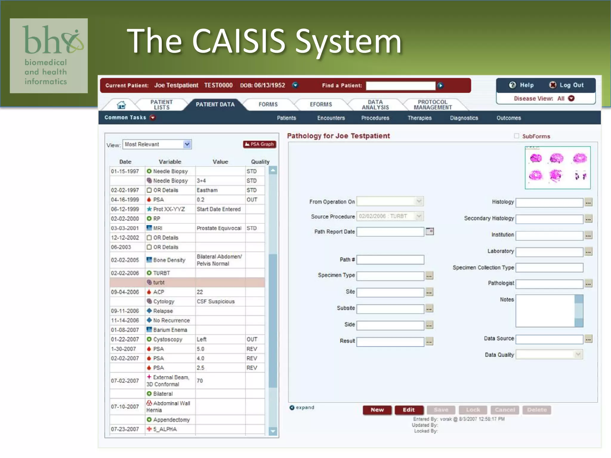 The CAISIS System