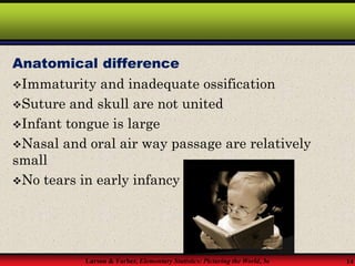 Larson & Farber, Elementary Statistics: Picturing the World, 3e 14
Anatomical difference
Immaturity and inadequate ossification
Suture and skull are not united
Infant tongue is large
Nasal and oral air way passage are relatively
small
No tears in early infancy
 