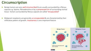 Circumscription
 Benign tumors are very well circumscribed & are usually surrounded by a fibrous
capsule e.g. lipoma, fibroadenoma or by a compressed rim of surrounding normal
tissue. Tumors surrounded by fibrous capsule are called “encapsulated”
 Malignant neoplasms are generally un-encapsulated & are characterized by their
infiltrative pattern of growth. Invasiveness is one important feature
 