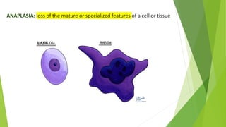 ANAPLASIA: loss of the mature or specialized features of a cell or tissue
 