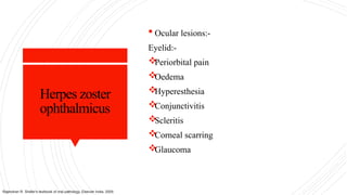Herpes zoster
ophthalmicus
 Ocular lesions:-
Eyelid:-

Periorbital pain

Oedema

Hyperesthesia

Conjunctivitis

Scleritis

Corneal scarring

Glaucoma
Rajendran R. Shafer's textbook of oral pathology. Elsevier India; 2009.
 