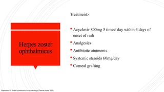 Herpes zoster
ophthalmicus
Treatment:-
 Acyclovir 800mg 5 times/ day within 4 days of
onset of rash
 Analgesics
 Antibiotic ointments
 Systemic steroids 60mg/day
 Corneal grafting
Rajendran R. Shafer's textbook of oral pathology. Elsevier India; 2009.
 