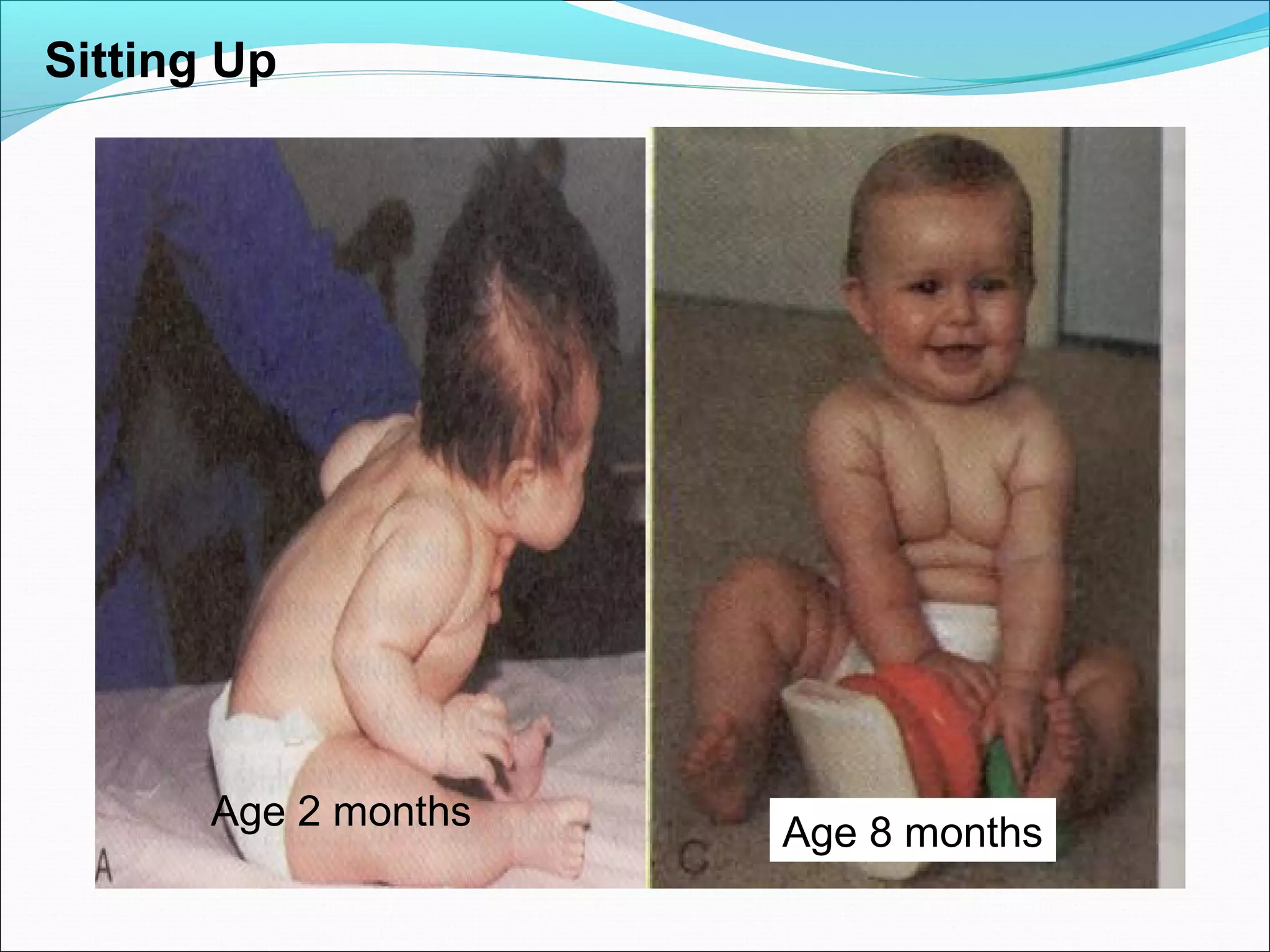 Sitting Up
Age 2 months
Age 8 months
 