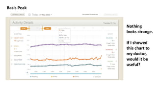 Basis Peak
Nothing
looks strange.
If I showed
this chart to
my doctor,
would it be
useful?
 