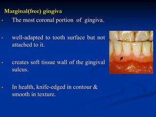 Marginal(free) gingiva
• The most coronal portion of gingiva.
• well-adapted to tooth surface but not
attached to it.
• creates soft tissue wall of the gingival
sulcus.
• In health, knife-edged in contour &
smooth in texture.
 
