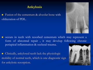  Fusion of the cementum & alveolar bone with
obliteration of PDL.
 occurs in teeth with resorbed cementum which may represent a
form of abnormal repair , it may develop following chronic
periapical inflammation & occlusal trauma.
 Clinically, ankylosed teeth lack the physiologic
mobility of normal teeth, which is one diagnostic sign
for ankylotic resorption.
Ankylosis
 
