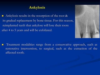  Ankylosis results in the resorption of the root &
its gradual replacement by bone tissue. For this reason,
reimplanted teeth that ankylose will lose their roots
after 4 to 5 years and will be exfoliated.
 Treatment modalities range from a conservative approach, such as
restorative intervention, to surgical, such as the extraction of the
affected tooth.
Ankylosis
 
