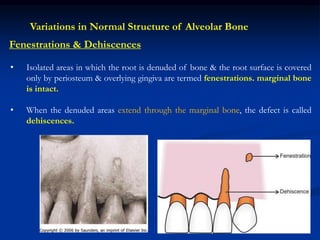 • Isolated areas in which the root is denuded of bone & the root surface is covered
only by periosteum & overlying gingiva are termed fenestrations. marginal bone
is intact.
• When the denuded areas extend through the marginal bone, the defect is called
dehiscences.
Fenestrations & Dehiscences
Variations in Normal Structure of Alveolar Bone
 