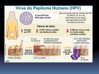 1o ano   ds ts - condiloma acuminado