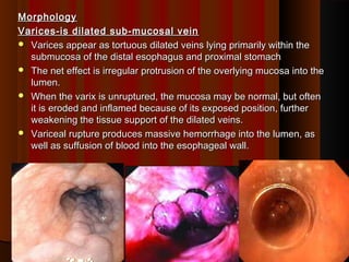 1oesophagus | PPT | Digestive Disorders | Diseases and Conditions
