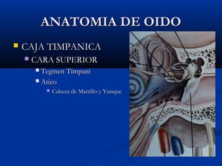 ANATOMIA DE OIDOANATOMIA DE OIDO
 CAJA TIMPANICACAJA TIMPANICA
 CARA SUPERIORCARA SUPERIOR
 Tegmen TímpaniTegmen Tímpani
 AticoAtico
 Cabeza de Martillo y YunqueCabeza de Martillo y Yunque
 