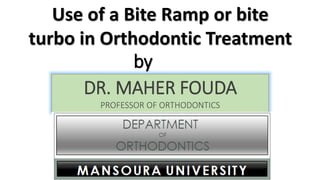 Use of a Bite Ramp or bite
turbo in Orthodontic Treatment
by
DR. MAHER FOUDA
PROFESSOR OF ORTHODONTICS
 