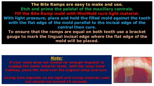 1 opening the bite with bite turbo 3m deep cure curing light