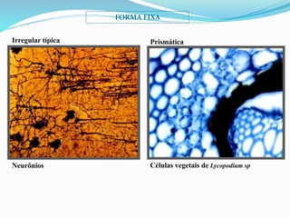 FORMA FIXA
Células vegetais de Lycopodium sp
PrismáticaIrregular típica
Neurônios
 