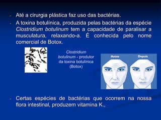 - Até a cirurgia plástica faz uso das bactérias.
- A toxina botulínica, produzida pelas bactérias da espécie
Clostridium botulinum tem a capacidade de paralisar a
musculatura, relaxando-a. É conhecida pelo nome
comercial de Botox.
Clostridium
botulinum - produtor
da toxina botulínica
(Botox)
- Certas espécies de bactérias que ocorrem na nossa
flora intestinal, produzem vitamina K.,
 