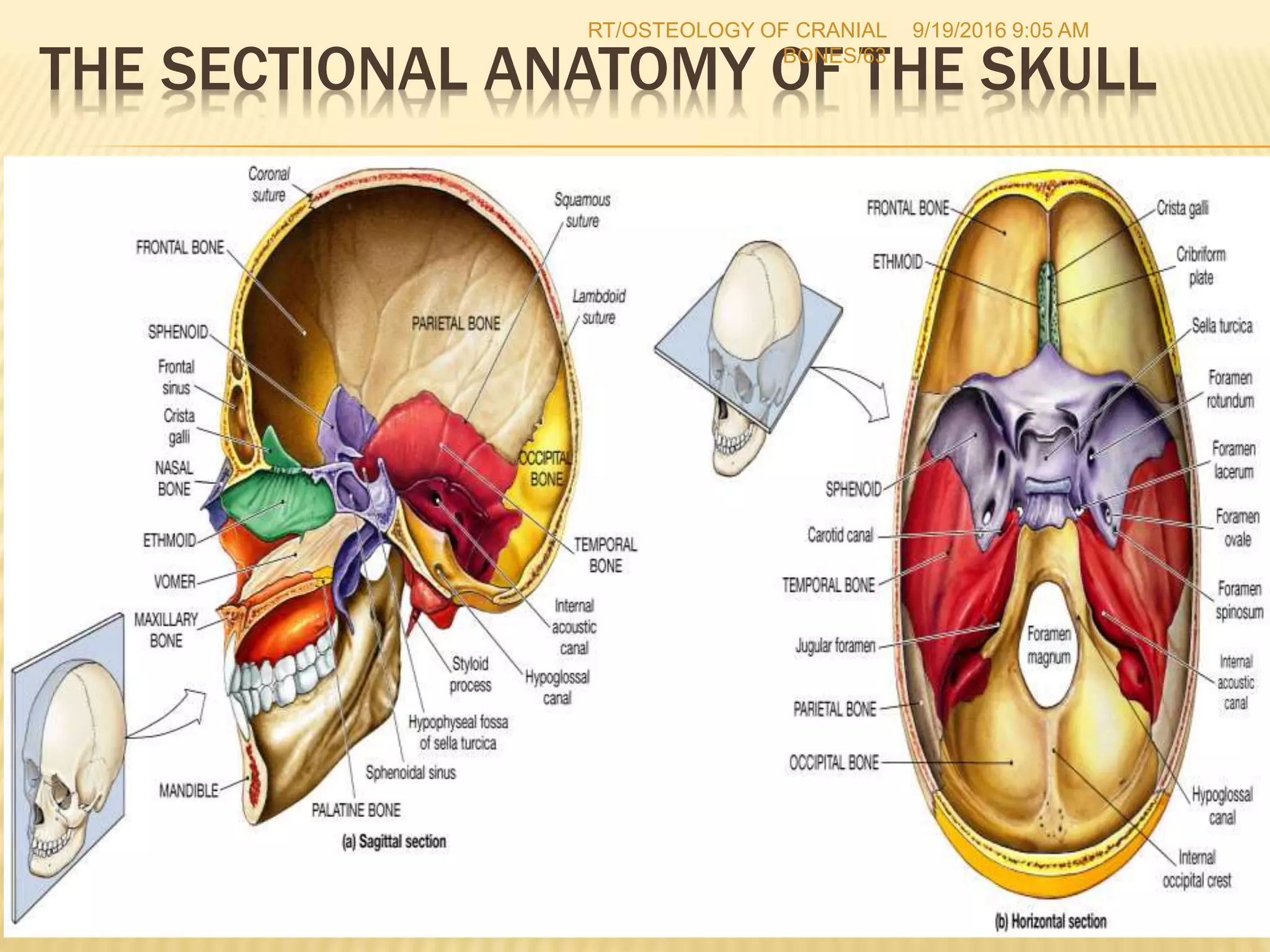 1 osteology of cranial bones rt(67) Dr. RAHUL TIWARI | PPTX