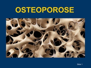 OSTEOPOROSE
Slide 1
 