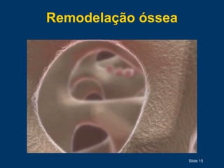 Remodelação óssea
Slide 15
 