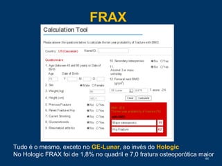 FRAX
44
Tudo é o mesmo, exceto no GE-Lunar, ao invés do Hologic
No Hologic FRAX foi de 1,8% no quadril e 7,0 fratura osteoporótica maior
 