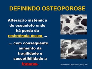Alteração sistêmica
do esqueleto onde
há perda da
resistência óssea ...
... com conseqüente... com conseqüente
aumento daaumento da
fragilidade efragilidade e
suscetibilidade asuscetibilidade a
fraturasfraturas.. World Health Organization (WHO), 2001
DEFININDO OSTEOPOROSE
 
