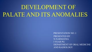 DEVELOPMENT OF
PALATE AND ITS ANOMALIES
PRESENTED BY
N.NARMATHA
I YEAR PG
DEPARTMENT OF ORAL MEDICINE
AND RADIOLOGY
PRESENTATION NO :1
 