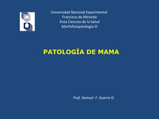 Universidad Nacional Experimental
Francisco de Miranda
Área Ciencias de la Salud
Morfofisiopatología III
Prof. Samuel F. Guerra G.
PATOLOGÍA DE MAMA
 