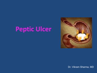 Peptic Ulcer
Dr. Vikram Sharma, MD
 