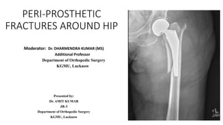 PERI-PROSTHETIC
FRACTURES AROUND HIP
Moderator: Dr. DHARMENDRA KUMAR (MS)
Additional Professor
Department of Orthopedic Surgery
KGMU, Lucknow
Presented by:
Dr. AMIT KUMAR
JR-3
Department of Orthopedic Surgery
KGMU, Lucknow
 