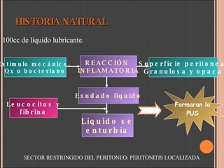 HISTORIA NATURAL  100cc de liquido lubricante. Estimulo mecánico,  Qx o bacteriano REACCIÓN  INFLAMATORIA Superficie peritoneal Granulosa y opaca Exudado liquido Liquido se enturbia Leucocitos y fibrina Formaran la PUS SECTOR RESTRINGIDO DEL PERITONEO: PERITONITIS LOCALIZADA 