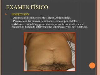 EXAMEN FÍSICO INSPECCIÓN - Ausencia o disminución: Mov. Resp. Abdominales.  - Paciente con las piernas flexionadas, inmóvil por el dolor.  - Abdomen distendido y generalmente es en forma simétrica si el paciente no ha tenido intervenciones quirúrgicas y no hay cicatrices.  