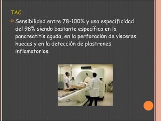 TAC Sensibilidad entre 78-100% y una especificidad del 98% siendo bastante espec í fica en la pancreatitis aguda, en la perforaci ó n de v í sceras huecas y en la detecci ó n de plastrones inflamatorios.     