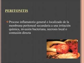 PERITONITIS Proceso inflamatorio general o localizado de la membrana peritoneal secundaria a una irritación química, invasión bacteriana, necrosis local o contusión directa 