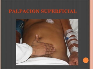 PALPACION SUPERFICIAL
 