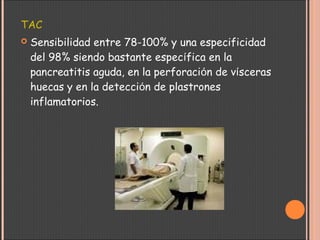 TAC
 Sensibilidad entre 78-100% y una especificidad
del 98% siendo bastante específica en la
pancreatitis aguda, en la perforación de vísceras
huecas y en la detección de plastrones
inflamatorios. 
 