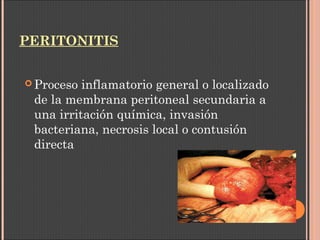 PERITONITIS
 Proceso inflamatorio general o localizado
de la membrana peritoneal secundaria a
una irritación química, invasión
bacteriana, necrosis local o contusión
directa
 