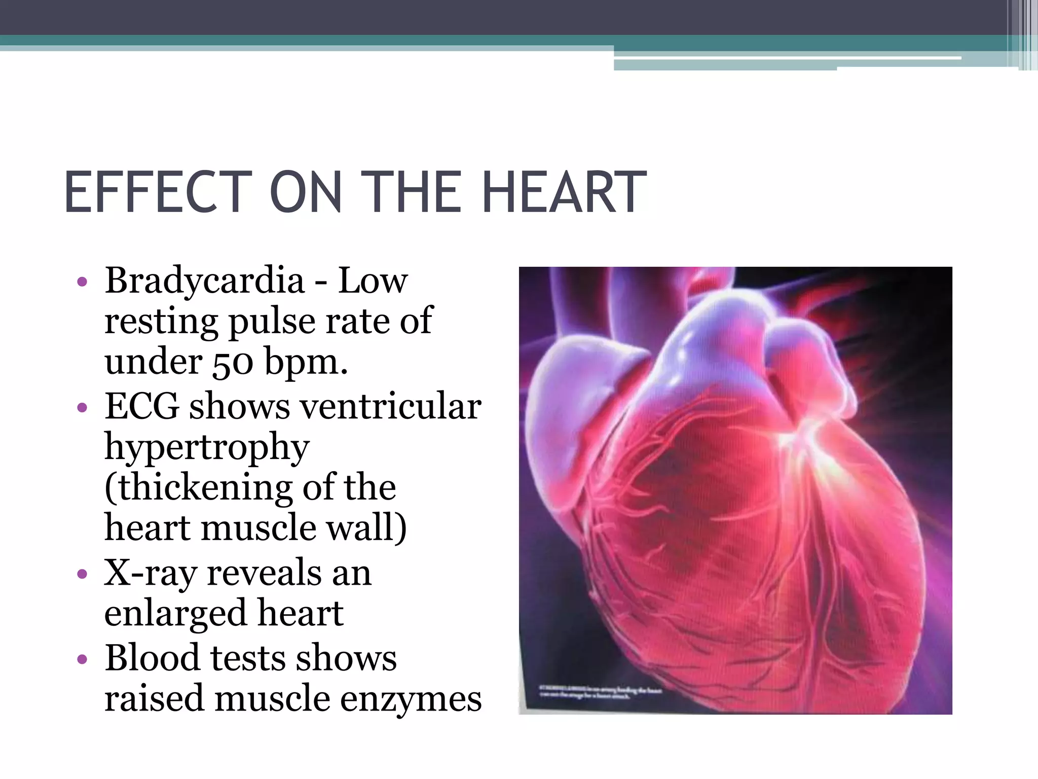 EFFECT ON THE HEART
• Bradycardia - Low
resting pulse rate of
under 50 bpm.
• ECG shows ventricular
hypertrophy
(thickening of the
heart muscle wall)
• X-ray reveals an
enlarged heart
• Blood tests shows
raised muscle enzymes
 
