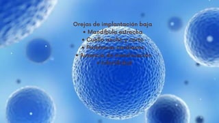 Orejas de implantación baja
• Mandíbula estrecha
• Cuello ancho y corto
• Problemas cardiacos
• Ausencia de menstruación
• Infertilidad














 