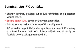 Keratoplasty recent advances and techniques | PPTX